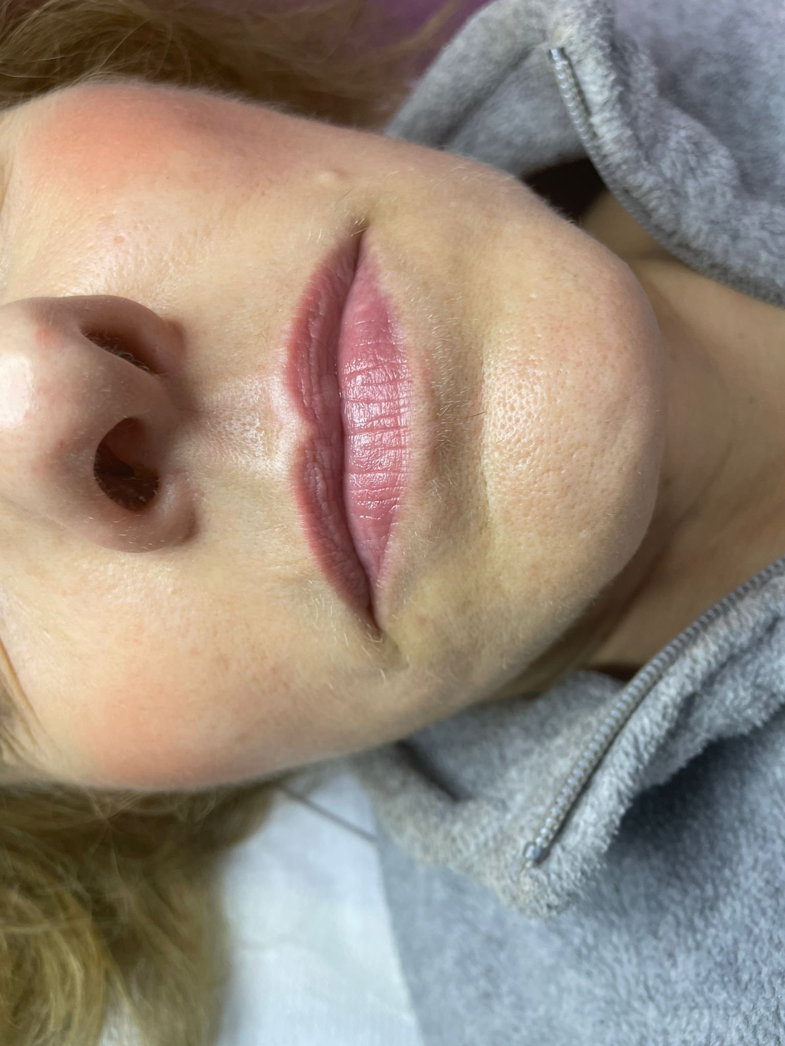 Tratamiento Estética 4